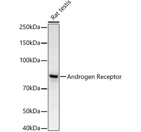 Western Blot - Anti-Androgen Receptor Antibody (A13837) - Antibodies.com