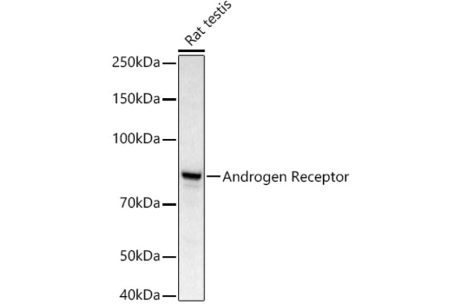 Western Blot - Anti-Androgen Receptor Antibody (A13837) - Antibodies.com
