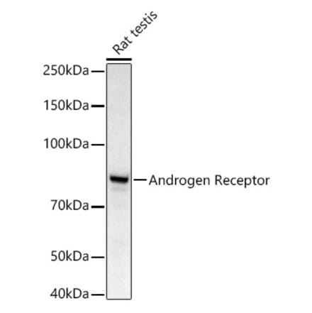 Western Blot - Anti-Androgen Receptor Antibody (A13837) - Antibodies.com