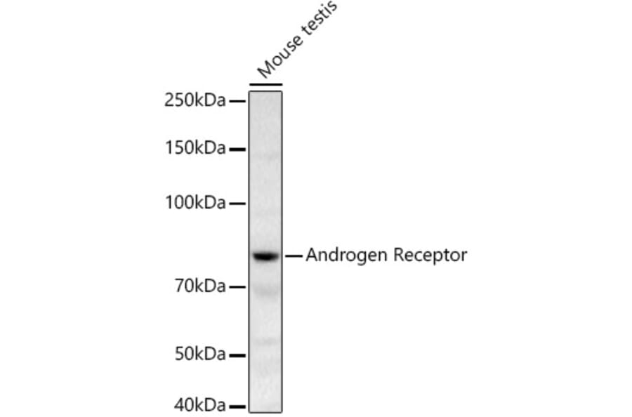 Western Blot - Anti-Androgen Receptor Antibody (A13837) - Antibodies.com