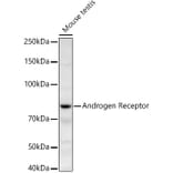 Western Blot - Anti-Androgen Receptor Antibody (A13837) - Antibodies.com