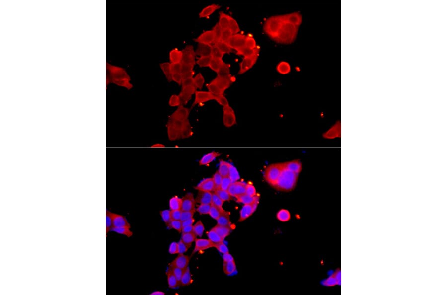 Immunofluorescence - Anti-Androgen Receptor Antibody (A13837) - Antibodies.com