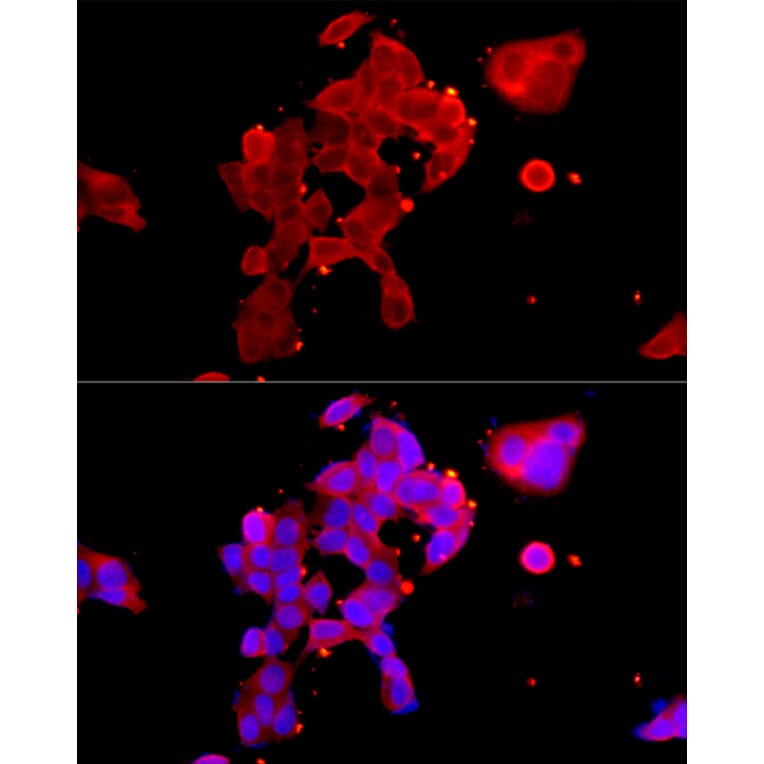 Immunofluorescence - Anti-Androgen Receptor Antibody (A13837) - Antibodies.com