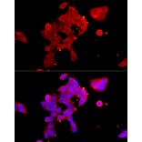 Immunofluorescence - Anti-Androgen Receptor Antibody (A13837) - Antibodies.com