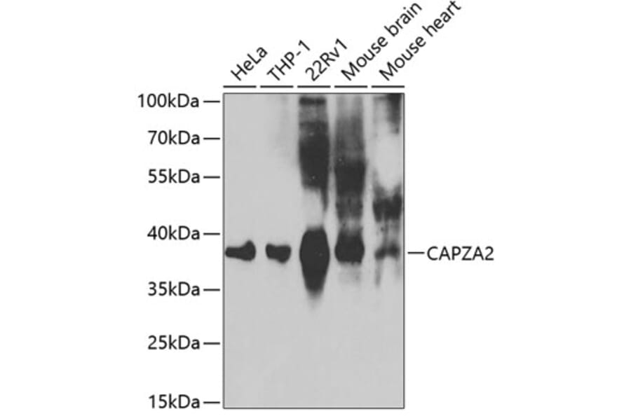 Western Blot - Anti-CAPZA2 Antibody (A13838) - Antibodies.com