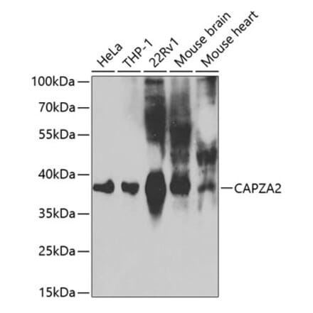 Western Blot - Anti-CAPZA2 Antibody (A13838) - Antibodies.com