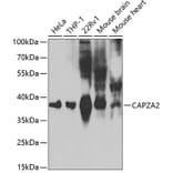 Western Blot - Anti-CAPZA2 Antibody (A13838) - Antibodies.com