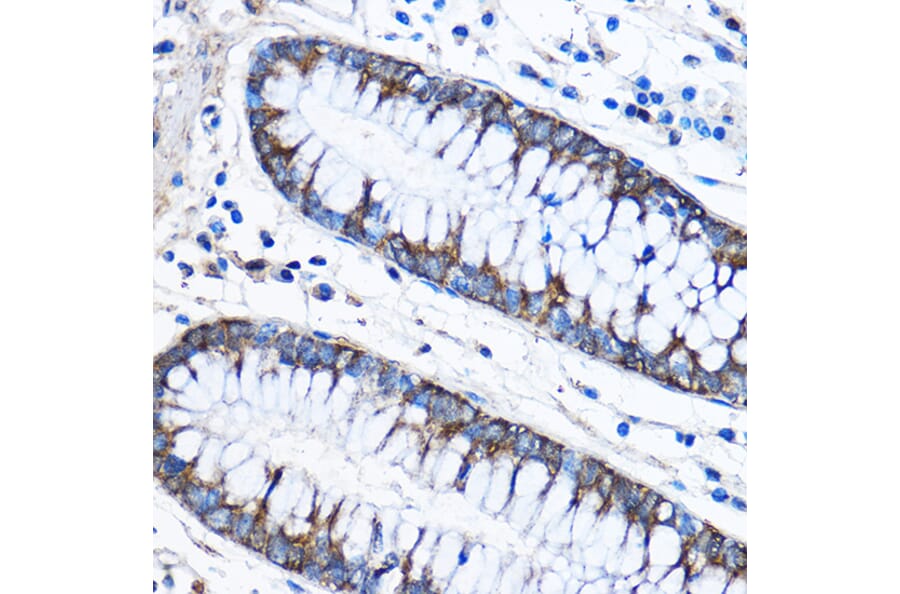 Immunohistochemistry - Anti-CAPZA2 Antibody (A13838) - Antibodies.com