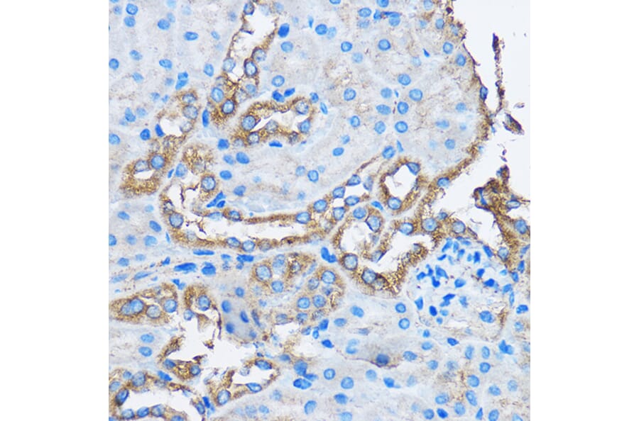 Immunohistochemistry - Anti-CAPZA2 Antibody (A13838) - Antibodies.com
