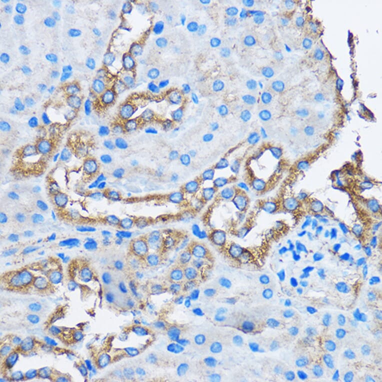 Immunohistochemistry - Anti-CAPZA2 Antibody (A13838) - Antibodies.com