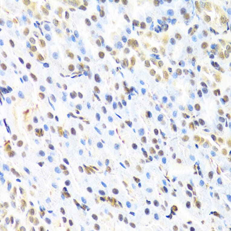 Immunohistochemistry - Anti-RUNX1/AML1 Antibody (A13839) - Antibodies.com