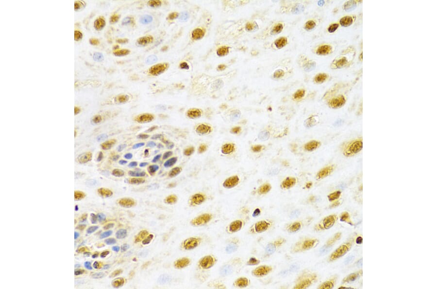 Immunohistochemistry - Anti-RUNX1/AML1 Antibody (A13839) - Antibodies.com