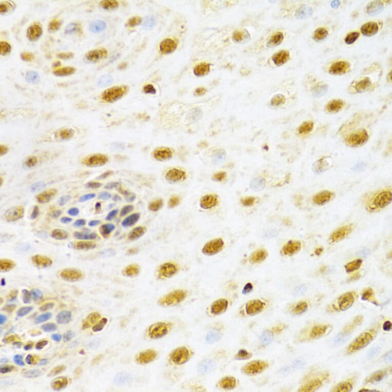 Immunohistochemistry - Anti-RUNX1/AML1 Antibody (A13839) - Antibodies.com