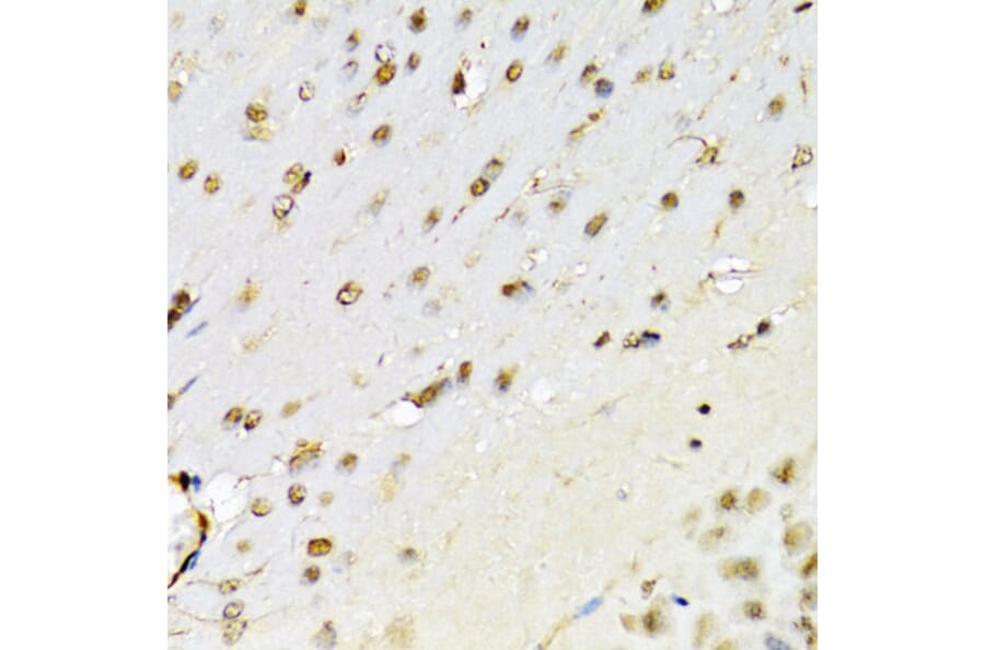 Immunohistochemistry - Anti-RUNX1/AML1 Antibody (A13839) - Antibodies.com