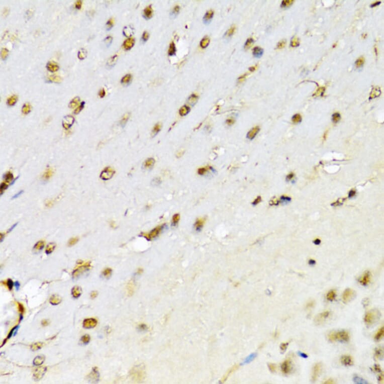 Immunohistochemistry - Anti-RUNX1/AML1 Antibody (A13839) - Antibodies.com