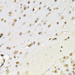 Immunohistochemistry - Anti-RUNX1/AML1 Antibody (A13839) - Antibodies.com