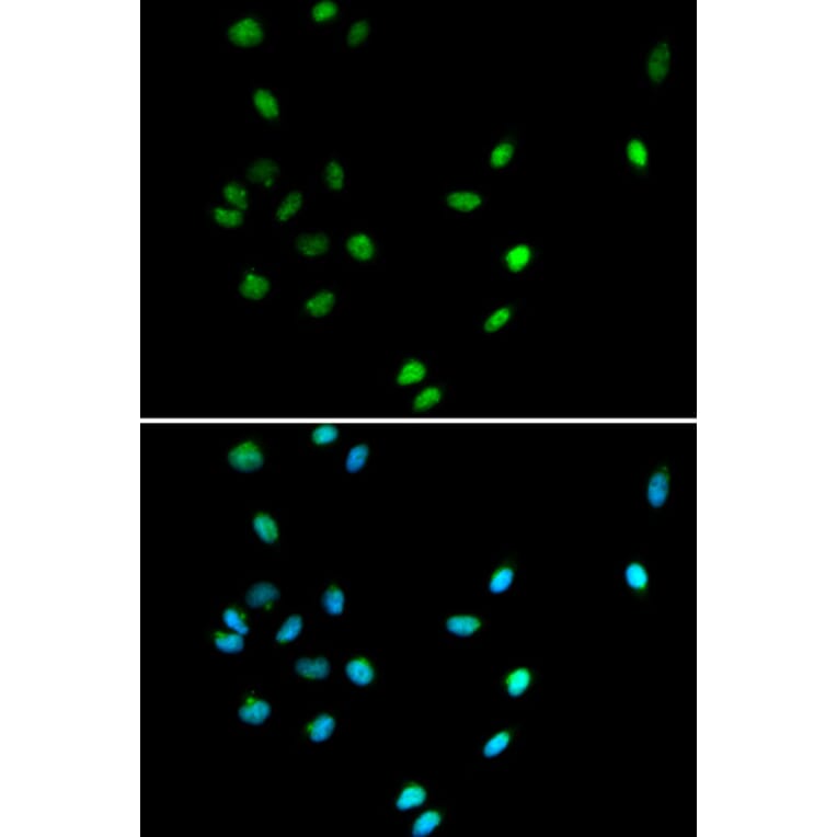 Immunofluorescence - Anti-RUNX1/AML1 Antibody (A13839) - Antibodies.com