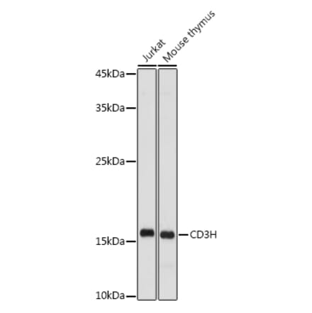 Western Blot - Anti-CD3 zeta Antibody (A13840) - Antibodies.com