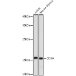 Western Blot - Anti-CD3 zeta Antibody (A13840) - Antibodies.com