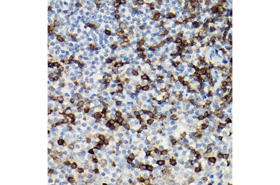 Immunohistochemistry - Anti-CD3 zeta Antibody (A13840) - Antibodies.com