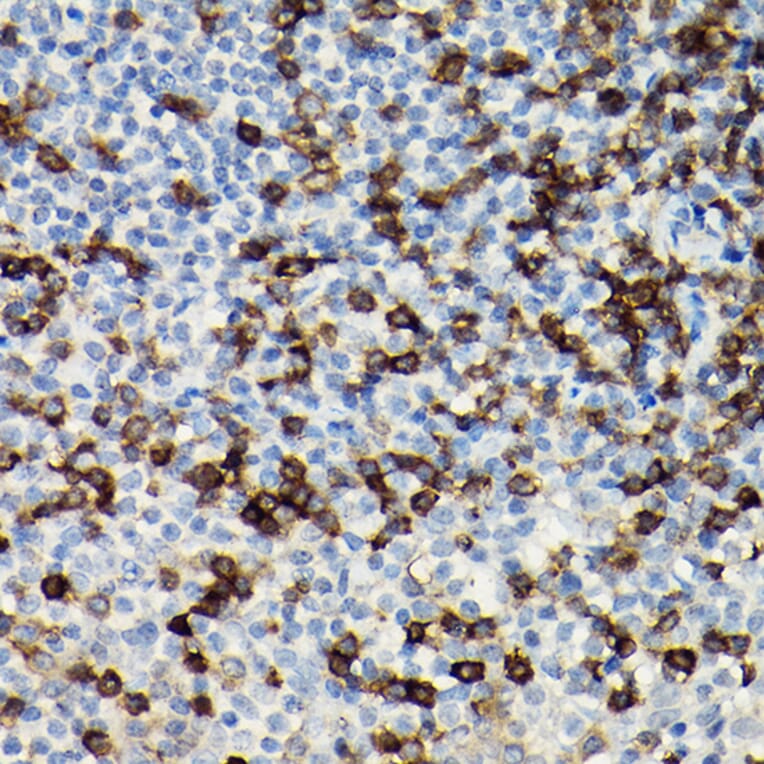 Immunohistochemistry - Anti-CD3 zeta Antibody (A13840) - Antibodies.com