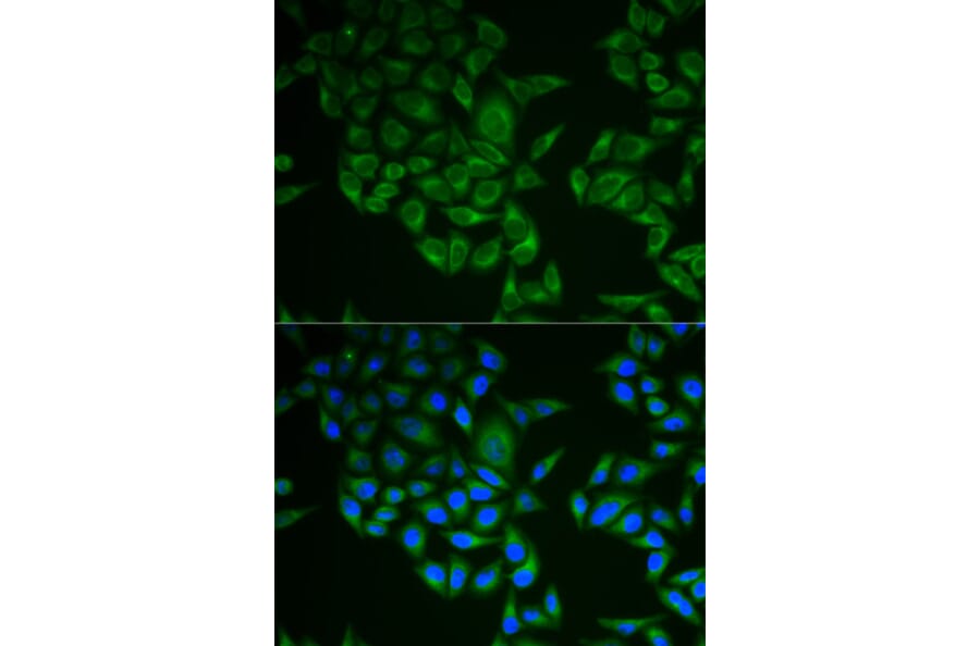 Immunofluorescence - Anti-CD3 zeta Antibody (A13840) - Antibodies.com