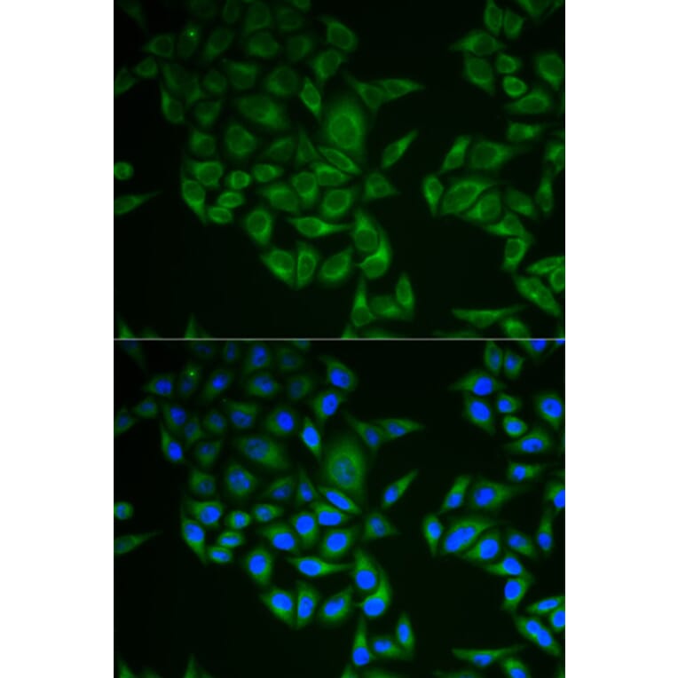 Immunofluorescence - Anti-CD3 zeta Antibody (A13840) - Antibodies.com