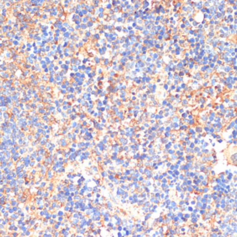 Immunohistochemistry - Anti-CD33 Antibody (A13841) - Antibodies.com