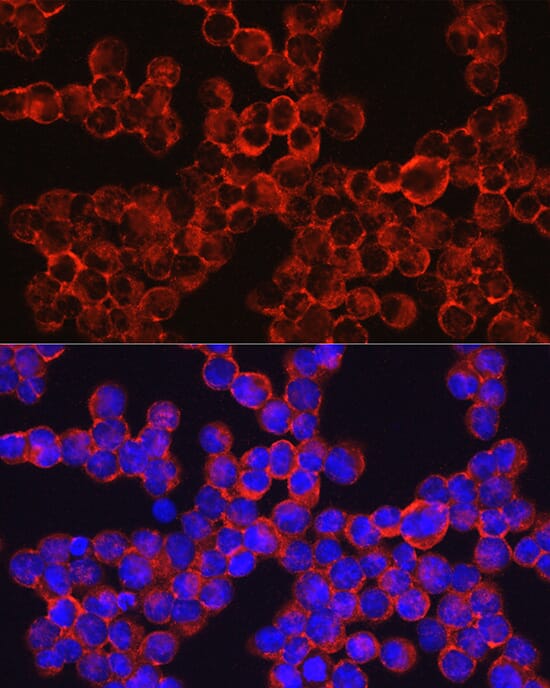 Anti-CD33 Antibody (A13841) | Antibodies.com