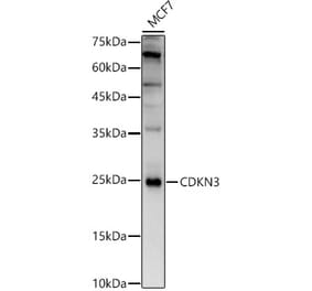 Western Blot - Anti-CDKN3 Antibody (A13842) - Antibodies.com