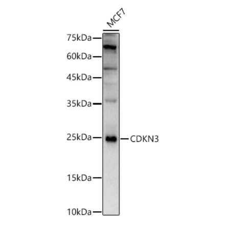 Western Blot - Anti-CDKN3 Antibody (A13842) - Antibodies.com