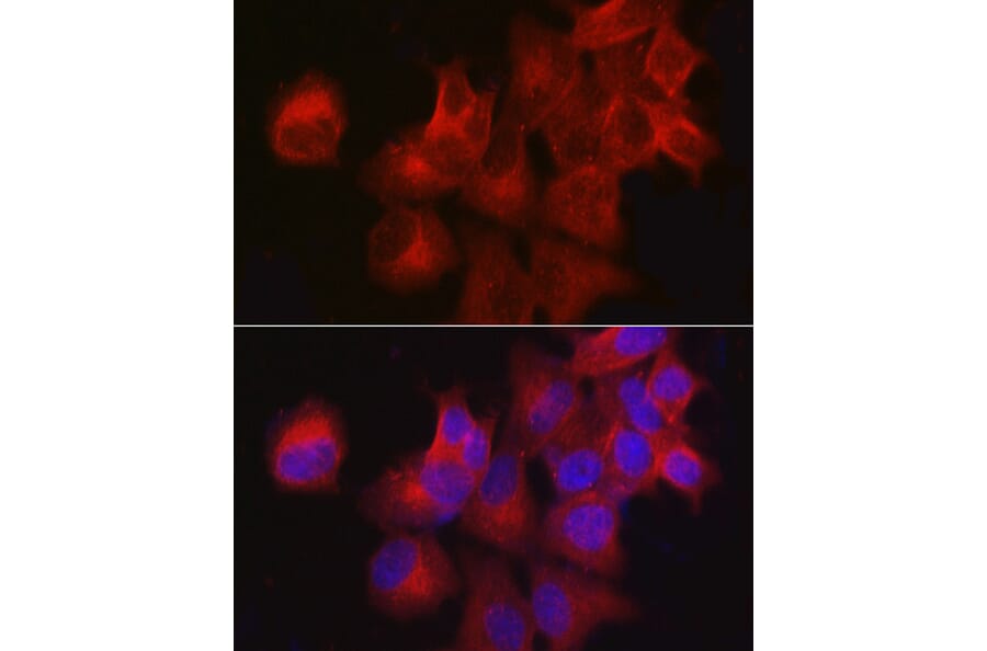 Immunofluorescence - Anti-CDKN3 Antibody (A13842) - Antibodies.com