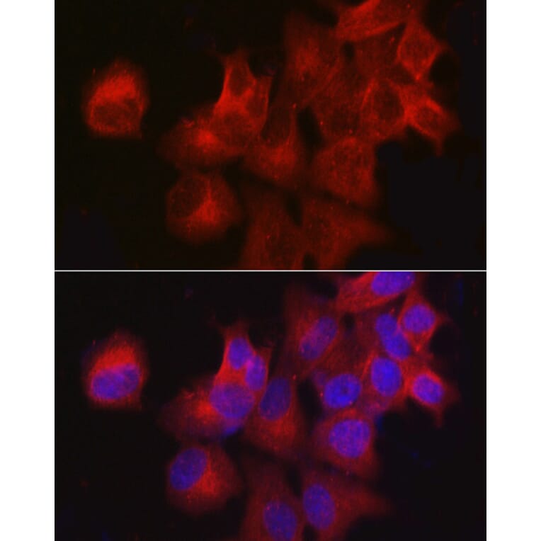 Immunofluorescence - Anti-CDKN3 Antibody (A13842) - Antibodies.com