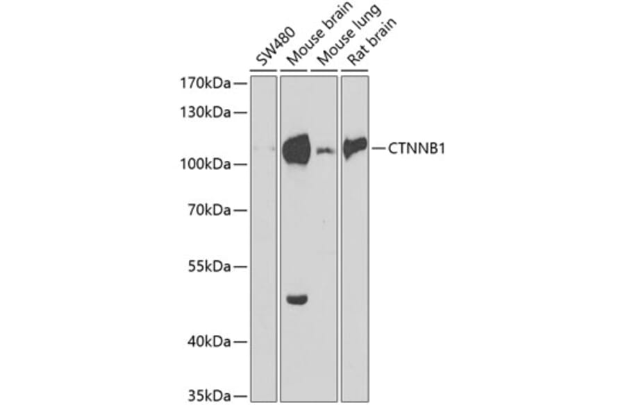 Western Blot - Anti-CTNNB1 Antibody (A2064) - Antibodies.com