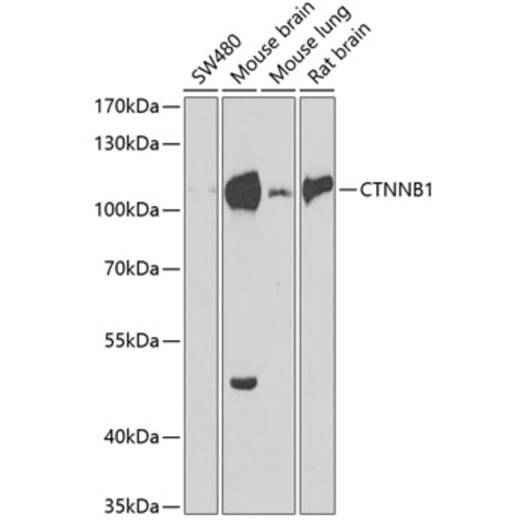 Western Blot - Anti-CTNNB1 Antibody (A2064) - Antibodies.com