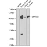 Western Blot - Anti-CTNNB1 Antibody (A2064) - Antibodies.com