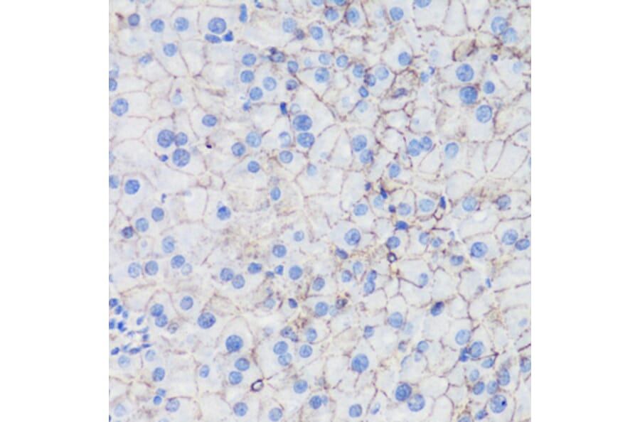 Immunohistochemistry - Anti-CTNNB1 Antibody (A2064) - Antibodies.com