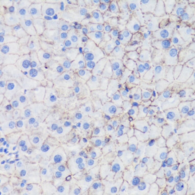 Immunohistochemistry - Anti-CTNNB1 Antibody (A2064) - Antibodies.com