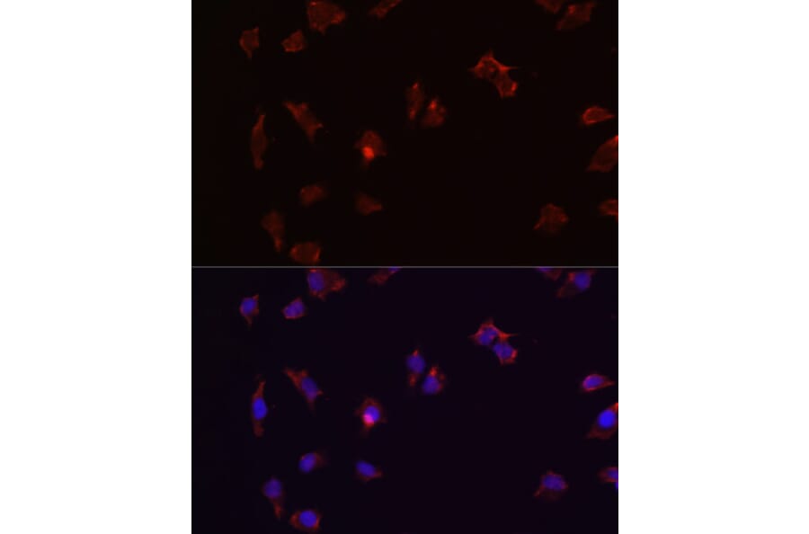 Immunofluorescence - Anti-CTNNB1 Antibody (A2064) - Antibodies.com