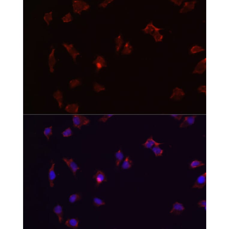 Immunofluorescence - Anti-CTNNB1 Antibody (A2064) - Antibodies.com