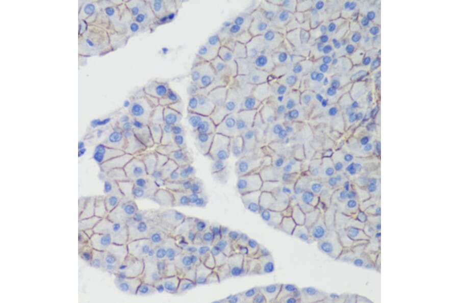 Immunohistochemistry - Anti-CTNNB1 Antibody (A2064) - Antibodies.com
