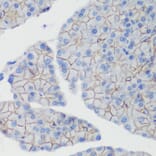 Immunohistochemistry - Anti-CTNNB1 Antibody (A2064) - Antibodies.com