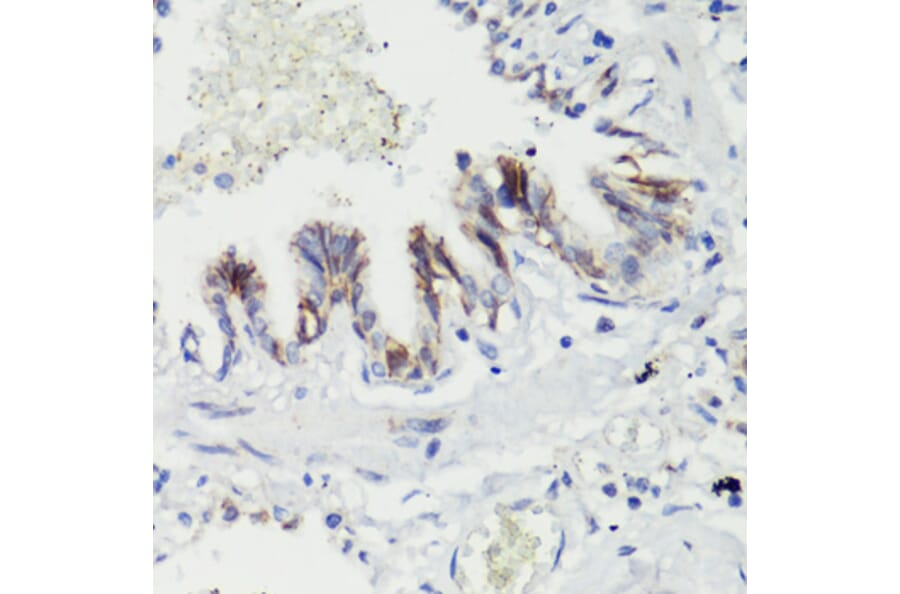 Immunohistochemistry - Anti-CTNNB1 Antibody (A2064) - Antibodies.com