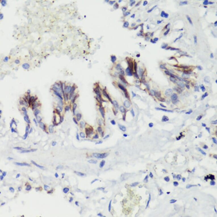 Immunohistochemistry - Anti-CTNNB1 Antibody (A2064) - Antibodies.com