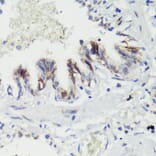 Immunohistochemistry - Anti-CTNNB1 Antibody (A2064) - Antibodies.com