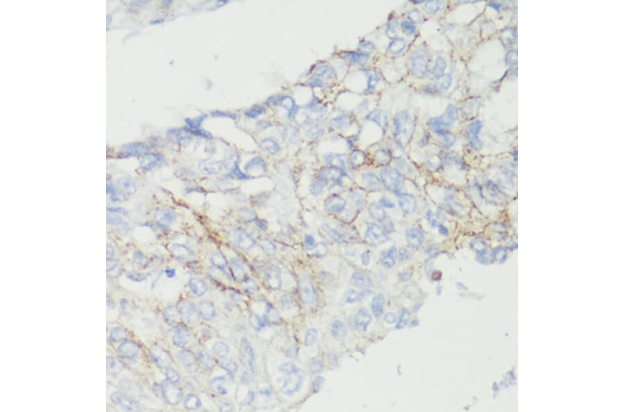 Immunohistochemistry - Anti-CTNNB1 Antibody (A2064) - Antibodies.com