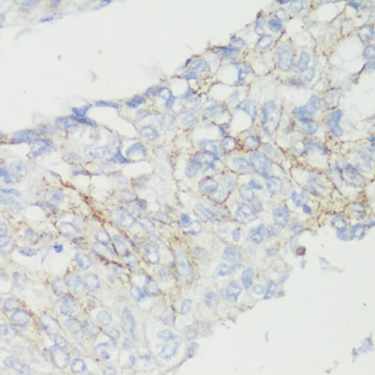 Immunohistochemistry - Anti-CTNNB1 Antibody (A2064) - Antibodies.com