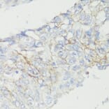 Immunohistochemistry - Anti-CTNNB1 Antibody (A2064) - Antibodies.com