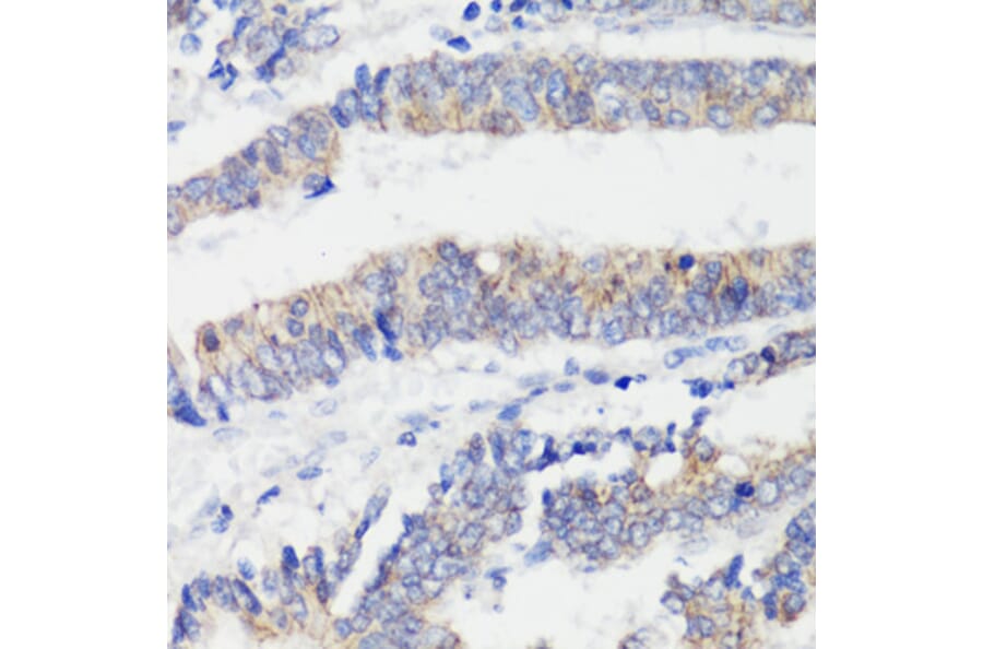 Immunohistochemistry - Anti-CTNNB1 Antibody (A2064) - Antibodies.com