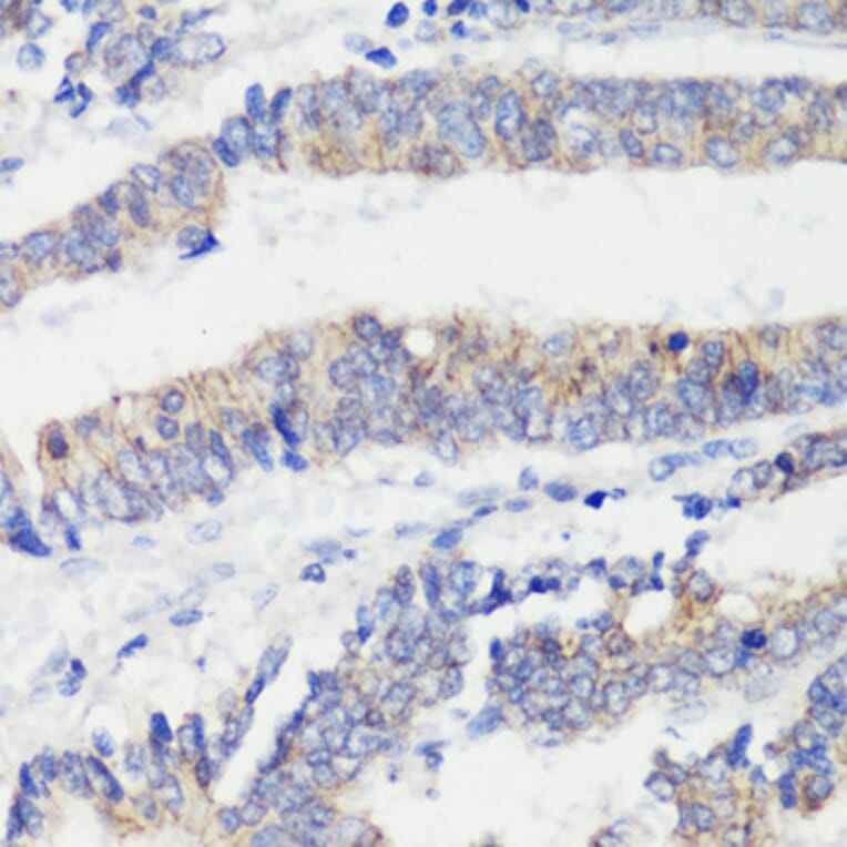 Immunohistochemistry - Anti-CTNNB1 Antibody (A2064) - Antibodies.com